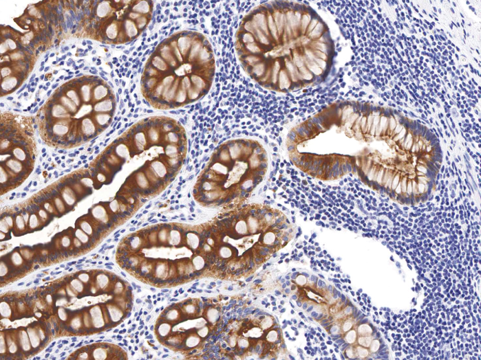 Antibody Anti-CEA (Carcinoembryonic Antigen) (Hu) from Mouse (IHC543) - unconj.