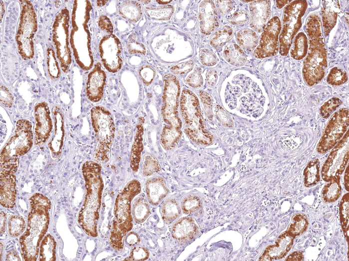 Antibody Anti-Napsin-A (NAPSA) (Hu) from Mouse (IHC635) - unconj.