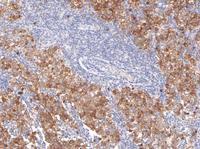 Antikörper Anti-Podoplanin (PDPN) (Hu) aus Maus (IHC650) - unkonj.