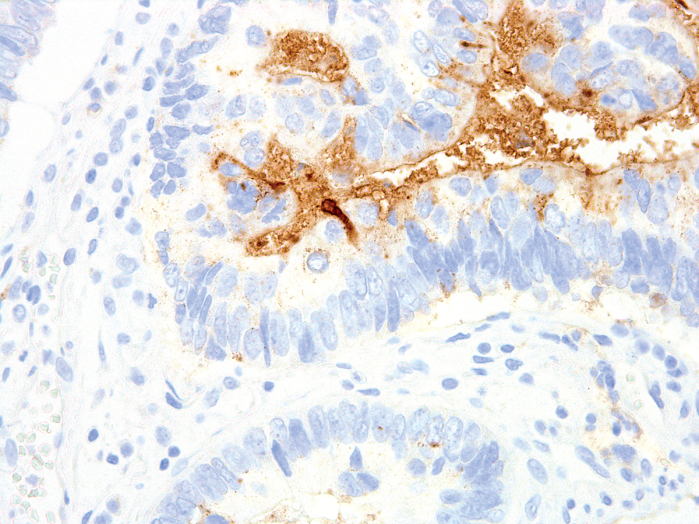 Antibody Anti-Tumor-associated glycoprotein 72 (Tag-72) (Hu) from Mouse (IHC072) - unconj.
