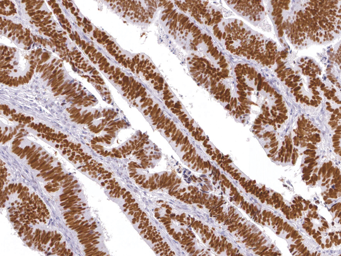 Antikörper Anti-p53 tumor suppressor (p53) (Hu) aus Maus (IHC053) - unkonj.