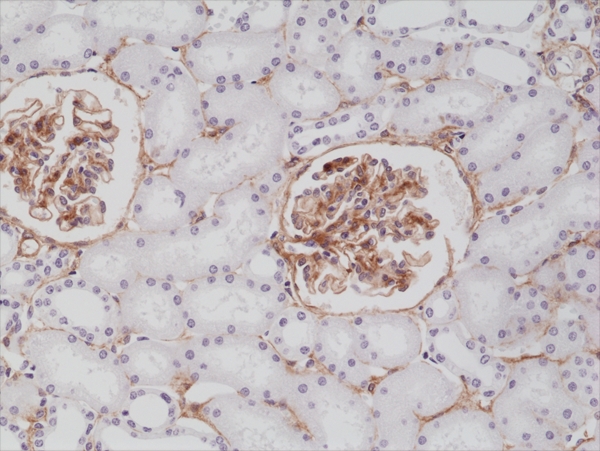 Antibody Anti-Platelet-derived Growth Factor Receptor beta (PDGFRB) from Rabbit - unconj.