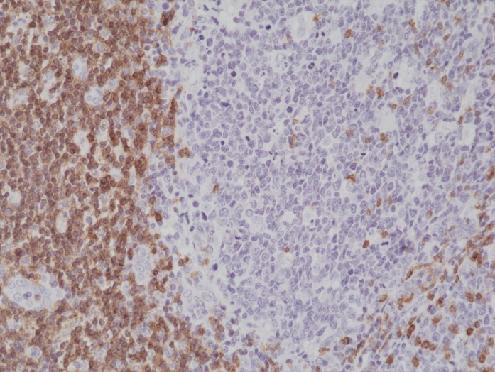 Antikörper Anti-CD5 (LEU1) aus Kaninchen (RM314) - unkonj.