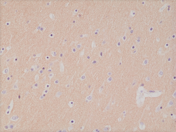Antibody Anti-CD56 (NCAM) from Rabbit - unconj.