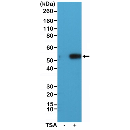 Antikörper Anti-Acetyl-alpha-Tubulin (Lys40) aus Kaninchen (RM318) - unkonj.