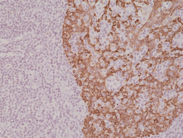 Antikörper Anti-Cytokeratin 14 (KRT14) aus Kaninchen (RM328) - unkonj.