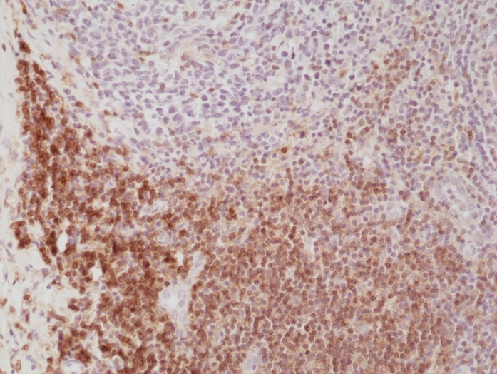 Antikörper Anti-CD4 (LEU3) aus Kaninchen (RM345) - unkonj.