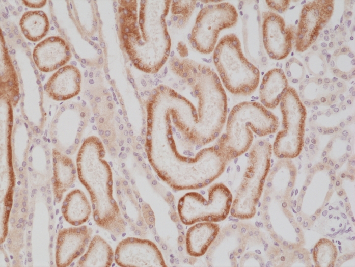 Antibody Anti-AMACR (p504s) from Rabbit - unconj.