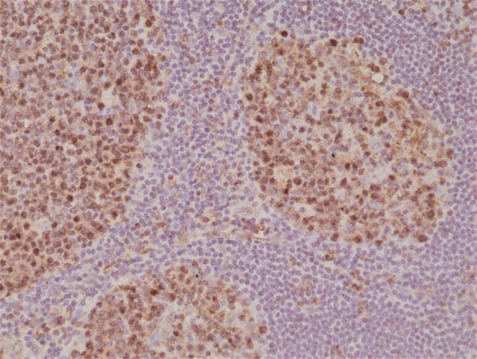 Antibody Anti-Stathmin (STMN1) from Rabbit - unconj.