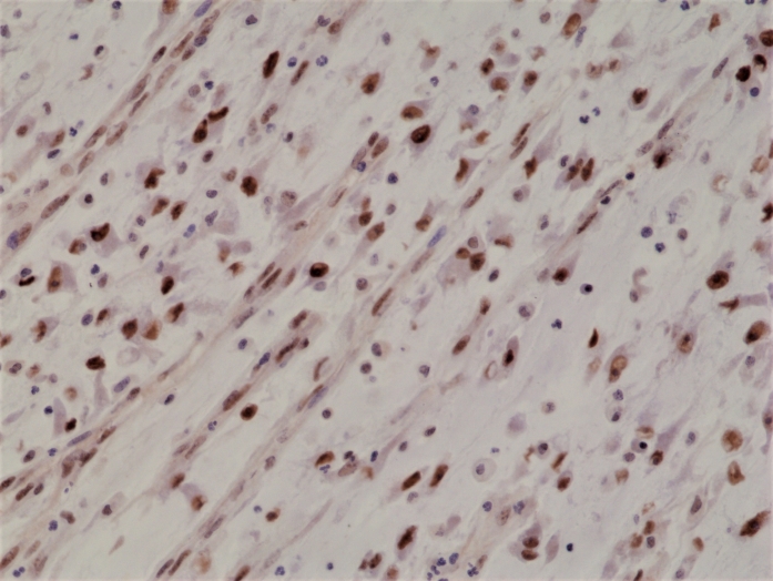 Antikörper Anti-Myoblast determination protein 1 (MYOD1) aus Kaninchen (RM369) - unkonj.
