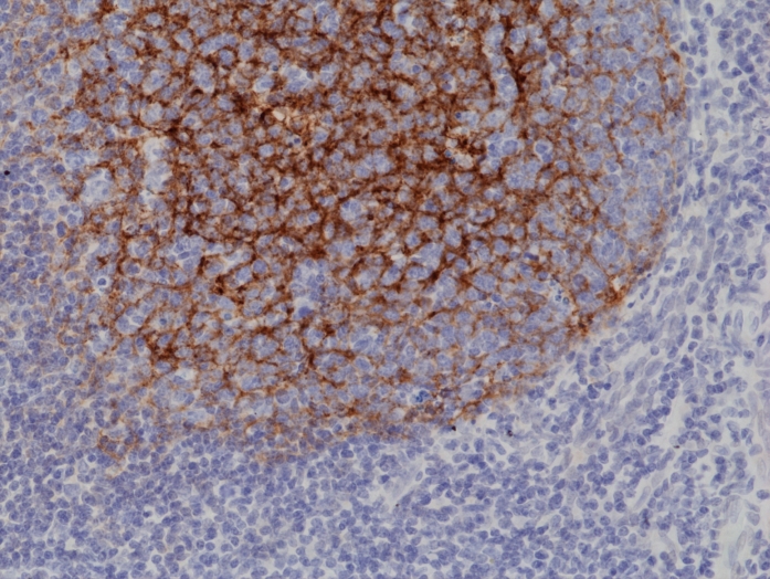Antikörper Anti-CD21 (CR2) aus Kaninchen (RM372) - unkonj.
