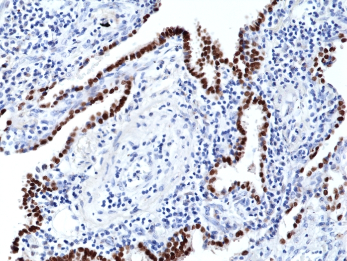 Antikörper Anti-Thyroid transcription Factor 1 (TITF1) aus Kaninchen (RM373) - unkonj.