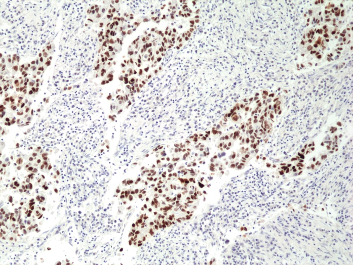 Antibody Anti-p53 tumor suppressor (p53) from Rabbit - unconj.