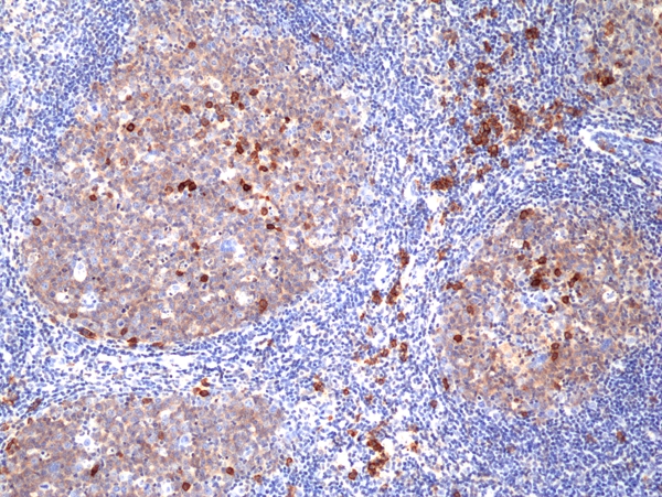 Antibody Anti-CD38 from Rabbit - unconj.