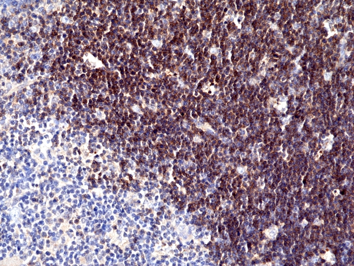 Antibody Anti-CD1A from Rabbit - unconj.