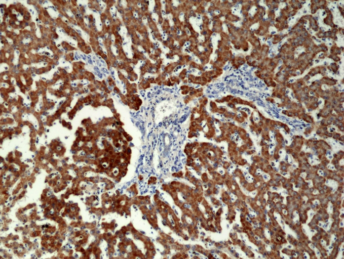 Antibody Anti-CPS1 from Rabbit - unconj.
