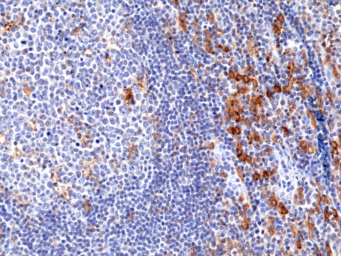 Antibody Anti-CD33 (SIGLEC3) from Rabbit - unconj.